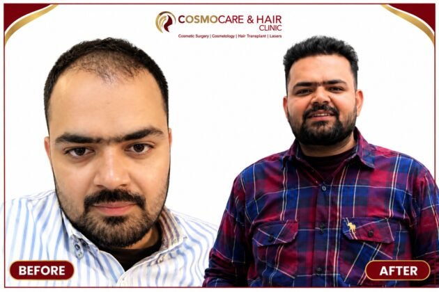 Hair restoration before and after